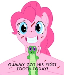 Size: 473x550 | Tagged: safe, artist:rydelfox, character:gummy, character:pinkie pie, species:earth pony, species:pony, blood, duo, female, grin, mare, smiling