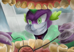 Size: 1909x1348 | Tagged: safe, artist:hewison, character:spike, dentist, offscreen character, pov, teeth