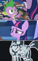 Size: 812x1320 | Tagged: safe, edit, edited screencap, screencap, character:spike, character:twilight sparkle, character:twilight sparkle (alicorn), species:alicorn, species:dragon, species:pony, episode:father knows beast, g4, my little pony: friendship is magic, book, comic, heart, heartbreak, sad, screencap comic, winged spike, x-ray, x-ray picture