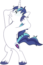 Size: 1984x3023 | Tagged: safe, artist:outlawquadrant, screencap, character:shining armor, species:pony, species:unicorn, episode:the crystalling, g4, my little pony: friendship is magic, bipedal, cracked armor, crazy face, faec, hooves on face, messy hair, on hind legs, simple background, solo, transparent background